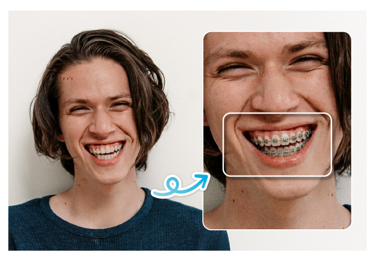 Mira cómo te verías con brackets en segundosa