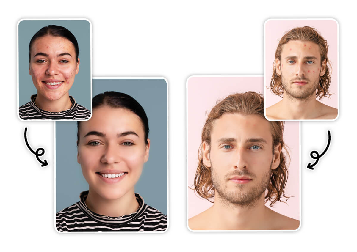 Remove Blemishes From Photo with AI