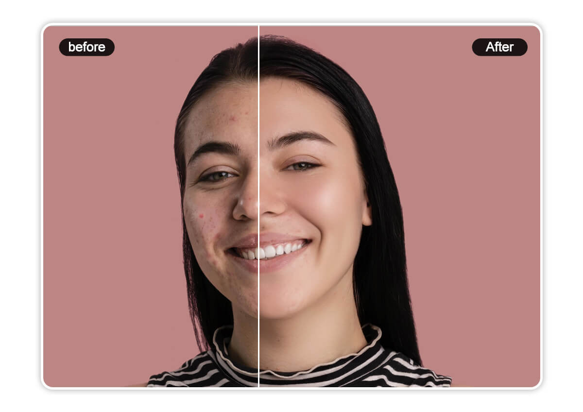 Blemish Remover