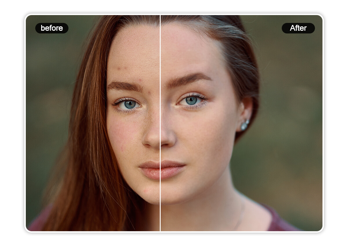Skin Smoother