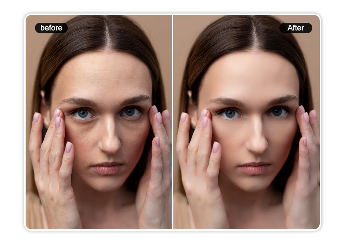 Eye Bag Remover