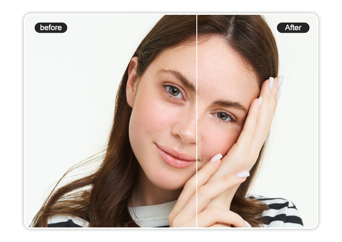 Dark Circle Remover