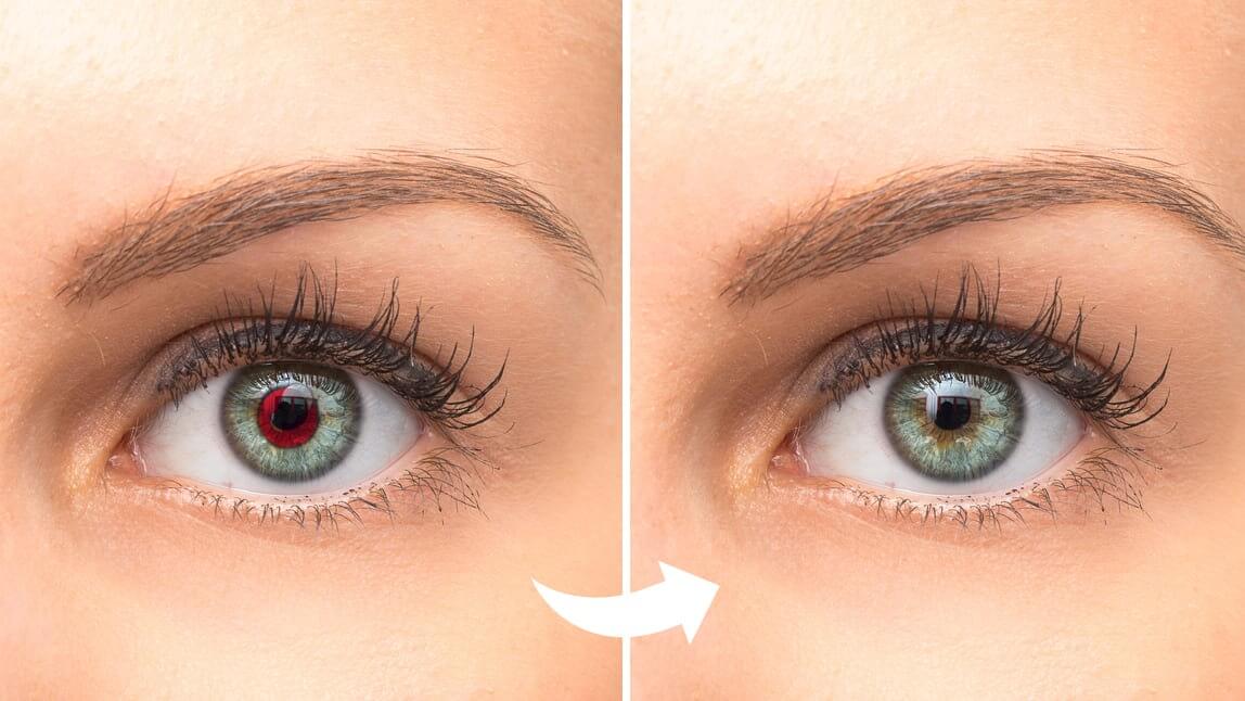 5 Points Forts du Meilleur Outil de Suppression des Yeux Rouges