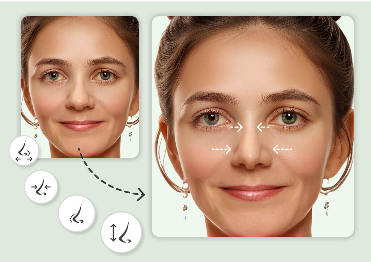 Perfeccioná tu Perfil con el Simulador de Rinoplastia IA